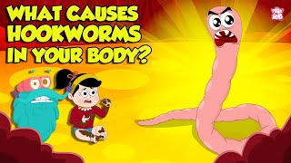 What causes Hookworm। Intestinal Worms Symptoms and Treatment  Worm Infection  Dr Binocs Show [upl. by Bela12]