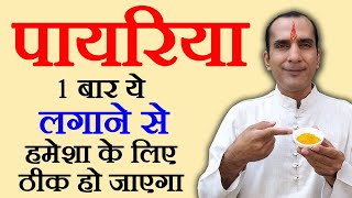 पायरिया जड़ से ठीक करने का घरेलु उपाय  payriya ka ilaj  Pyorrhea Treatment in Hindi [upl. by Virgilio]