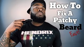 Quick and Easy Beard Growth Tips  Easy DIY How to Fix a Patchy Beard Fast Tutorial [upl. by Philippine]