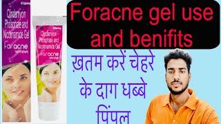 Foracne gel useदाग धब्बे पिंपलyoutubemadicinepharmacyytdoctorhospitalmedicalpimpleuse [upl. by Leuqar]