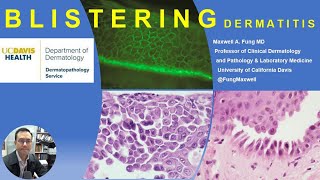 DERMATOPATHOLOGY Blistering Diseases [upl. by Leile]