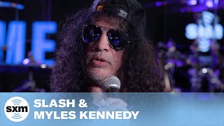 Slash Reveals How Everyone in the Group Caught Covid19  SiriusXM [upl. by Annwahs]