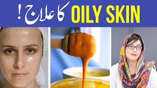 Oily Skin Ka Ilaj  How To Fix Oily Skin With Simple Hack  Home Remedies UrduHindi [upl. by Nesnar]