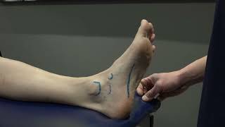 Foot and Ankle 2  Plantar Fascia and Spring Ligament Palpation [upl. by Acysej]