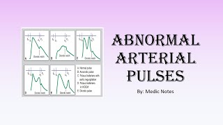 Types of arterial pulses  anacrotic bigeminal dicrotic pulsus alternans pulsus parvus et tardus [upl. by Som]