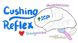 Cushing Reflex  Cushing Triad  Intracranial Hypertension  Emergency Medicine and EMS EMT [upl. by Limaa]