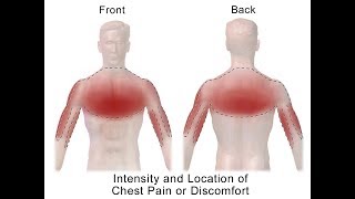 Distinguishing Types of Chest Pain [upl. by Goodkin]