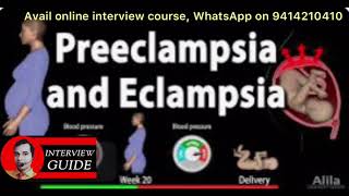 Preeclampsia and eclampsia l AMC interview questions  Army Doctor Interview  Interview Guide [upl. by Gorey]