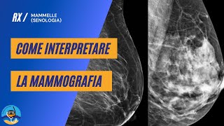 Come interpretare la mammografia [upl. by Vitkun]