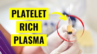 Platelet Rich Plasma PRP Injections Everything You Need to Know [upl. by Edny]