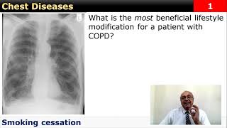 Chronic Obstructive Pulmonary Disease COPD Quick note internalmedicine cme محاضراتباطنة [upl. by Notfa]