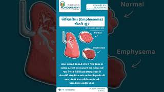 What is a emphysemaemphysemaempyemapneumothoraxhydrothoraxhemothoraxpyothorax [upl. by Drofiar]