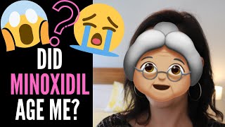 DOES MINOXIDIL  ROGAINE CAUSE AGING My Story  Doctors Thoughts On WRINKLES BAGS COLLAGEN LOSS [upl. by Sher]