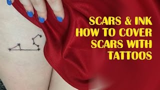 Scars amp Ink ►How to Cover Scars with Tattoos [upl. by Auguste]