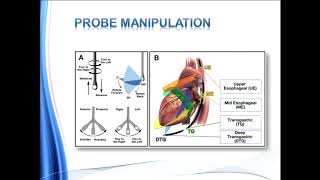 Transesophageal Echo TEE  ASESCA Guidelines for Performing a Comprehensive exam [upl. by Burck]