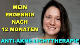 1 JAHR SPÄTER Neutrogena visibly clear AntiAkne Lichttherapie Maske Teil 14 [upl. by Ynnig91]