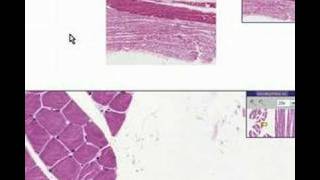 Histopathology Skeletal muscleAtrophy [upl. by Akisej]