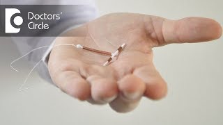 Birth control using intrauterine devices BIRTH CONTROL METHOD Dr Shefali Tyagi [upl. by Ydisac216]