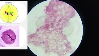 11th CLASS PRACTICAL  CELL DIVISION MEIOSIS 1 amp MEIOSIS 2  PROPHASE 5 STAGES  CBSE  GSEB bio [upl. by Gnilsia]