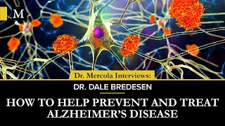 How to Help Prevent and Treat Alzheimers Disease – Interview With Dr Dale Bredesen [upl. by Odiug339]