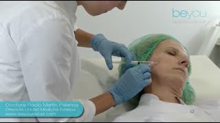 Mesoterapia Facial Tratamiento de medicina estética [upl. by Lunt]