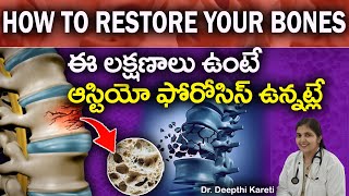 ఎముకులు గుల్లబారిందా  Osteoporosis  Causes symptoms treatment  Dr Deepthi Kareti [upl. by Htnamas]