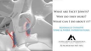 What are Facet Joints Why do they Hurt and How should they be Treated An Overview of Spine Facets [upl. by Gnen]