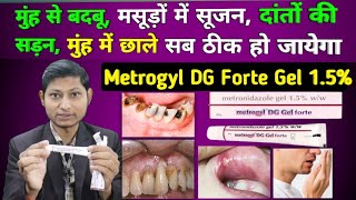 Metrogyl dg gel forte uses in hindi  metronidazole amp chlorhexidine gluconate solution dental gel [upl. by Magena329]