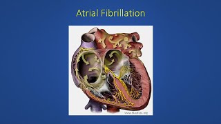 Normal Skipped or Irregular Heart Beats [upl. by Jemie]