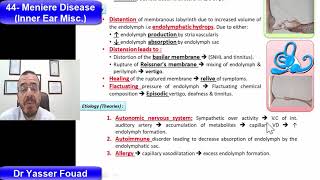 44 Meniere Disease [upl. by Sothena]